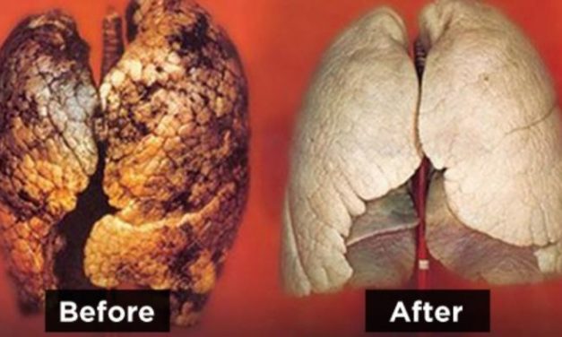 CARA ALAMI UNTUK BERSIHKAN PARU-PARU KOTOR AKIBAT ROKOK