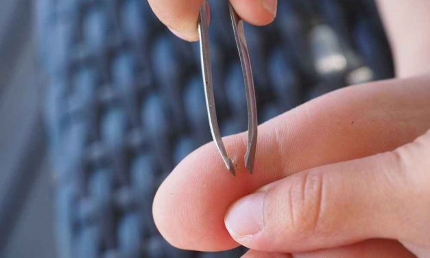 CARA CEPAT KELUARKAN DURI ATAU SERPIHAN KAYU DARI KULIT