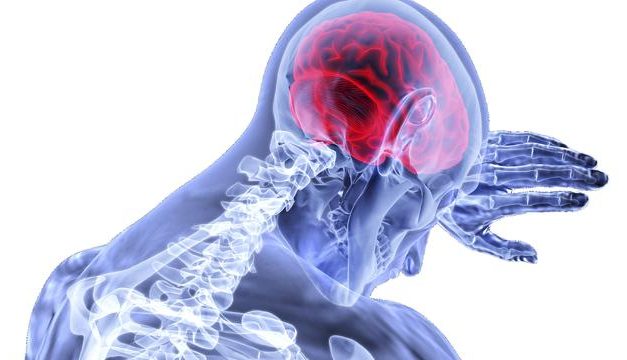 KEBIASAAN YANG MEMICU KERUSAKAN OTAK