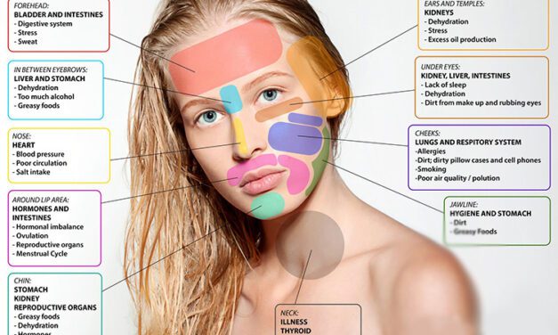 LETAK JERAWAT DAPAT MENANDAKAN KONDISI KESEHATAN